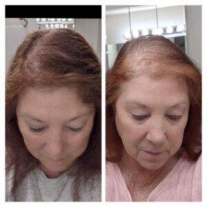 Before and after photo of hair growing back after using Glow liquid collagen