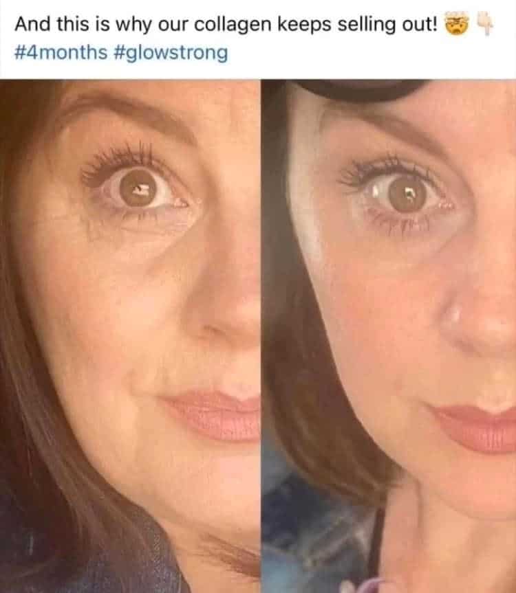 Before and after results from using Glow liquid collagen