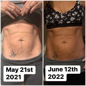 Before and after results from using Glow liquid collagen