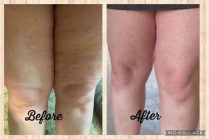 Before and after results from using Glow liquid collagen