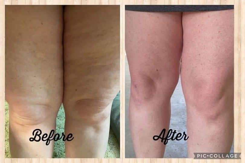 Before and after results from using Glow liquid collagen