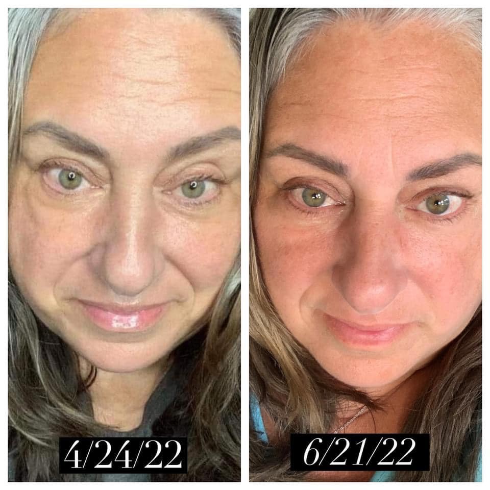 Before and after results from using Glow liquid collagen