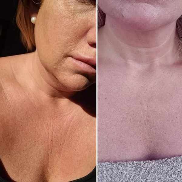 Before and after results from using Glow liquid collagen