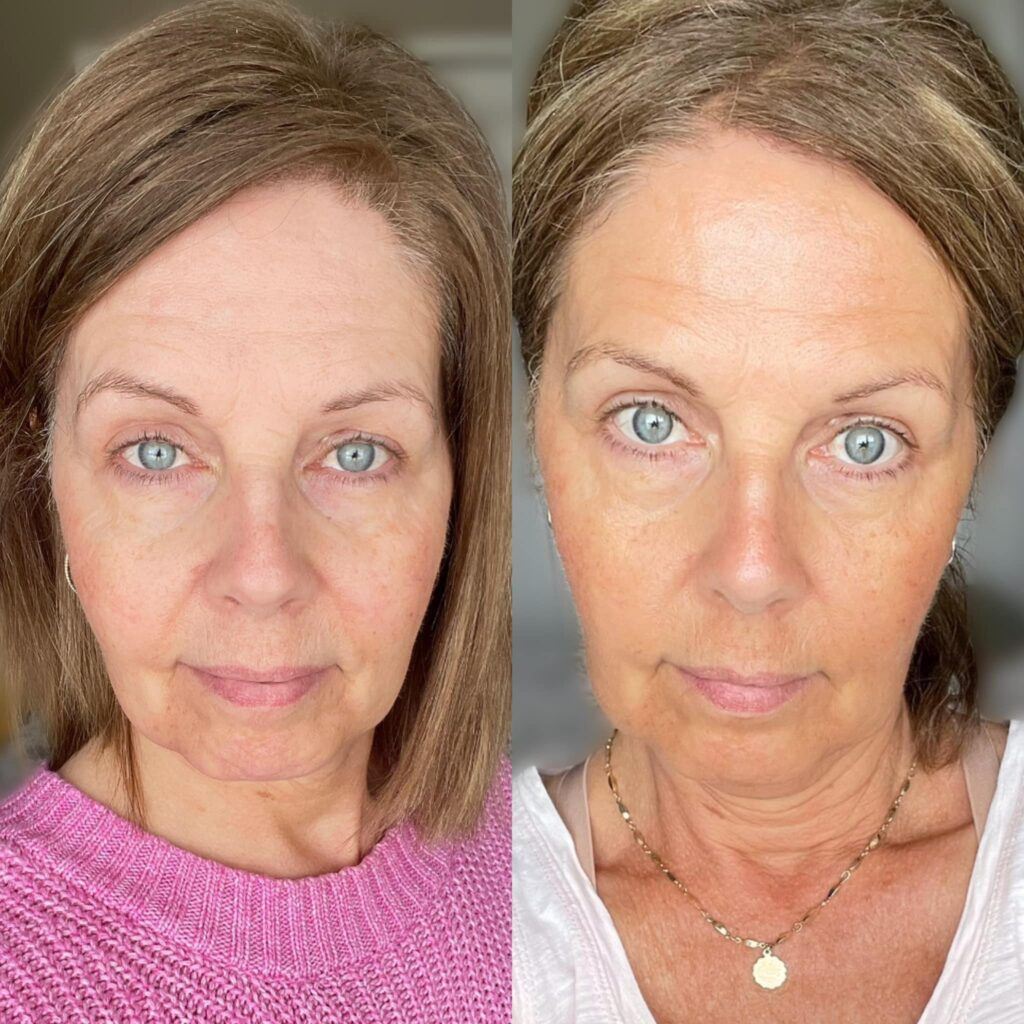 Before and after results from using Glow liquid collagen