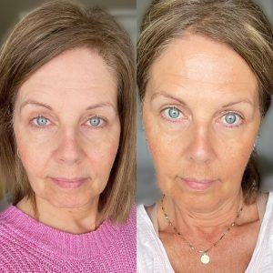 Before and after results from using Glow liquid collagen