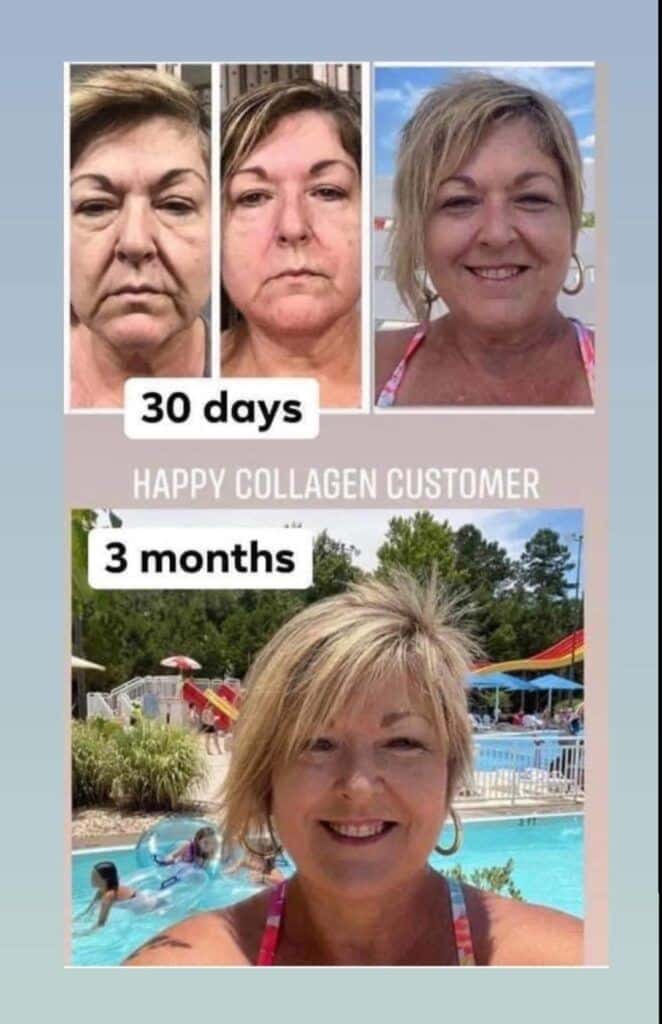 Before and after results from using Glow liquid collagen