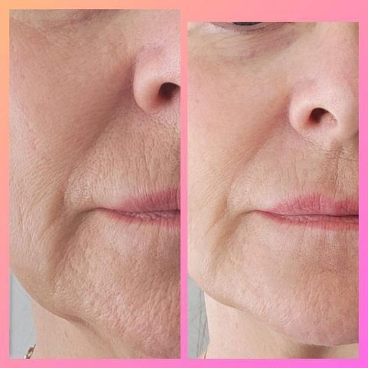 Before and after results from using Glow liquid collagen