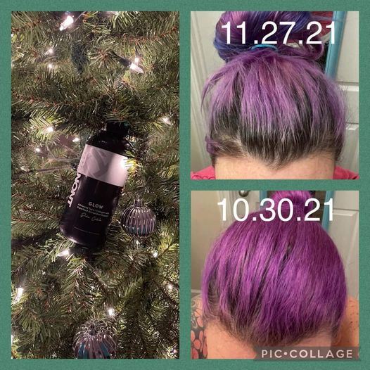 Before and after results from using Glow liquid collagen