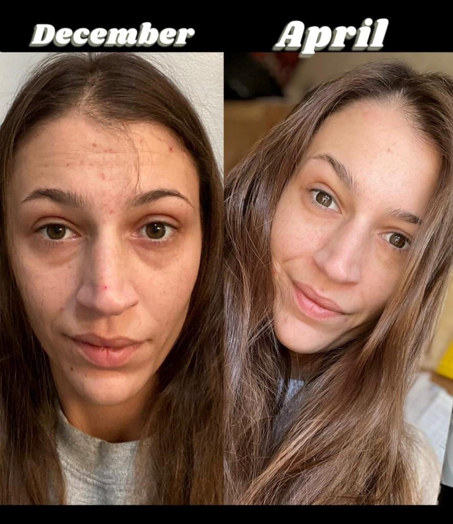 Before and after results from using Glow liquid collagen