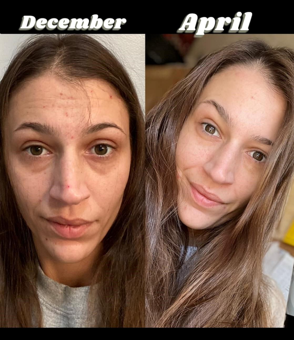 Before and after results from using Glow liquid collagen