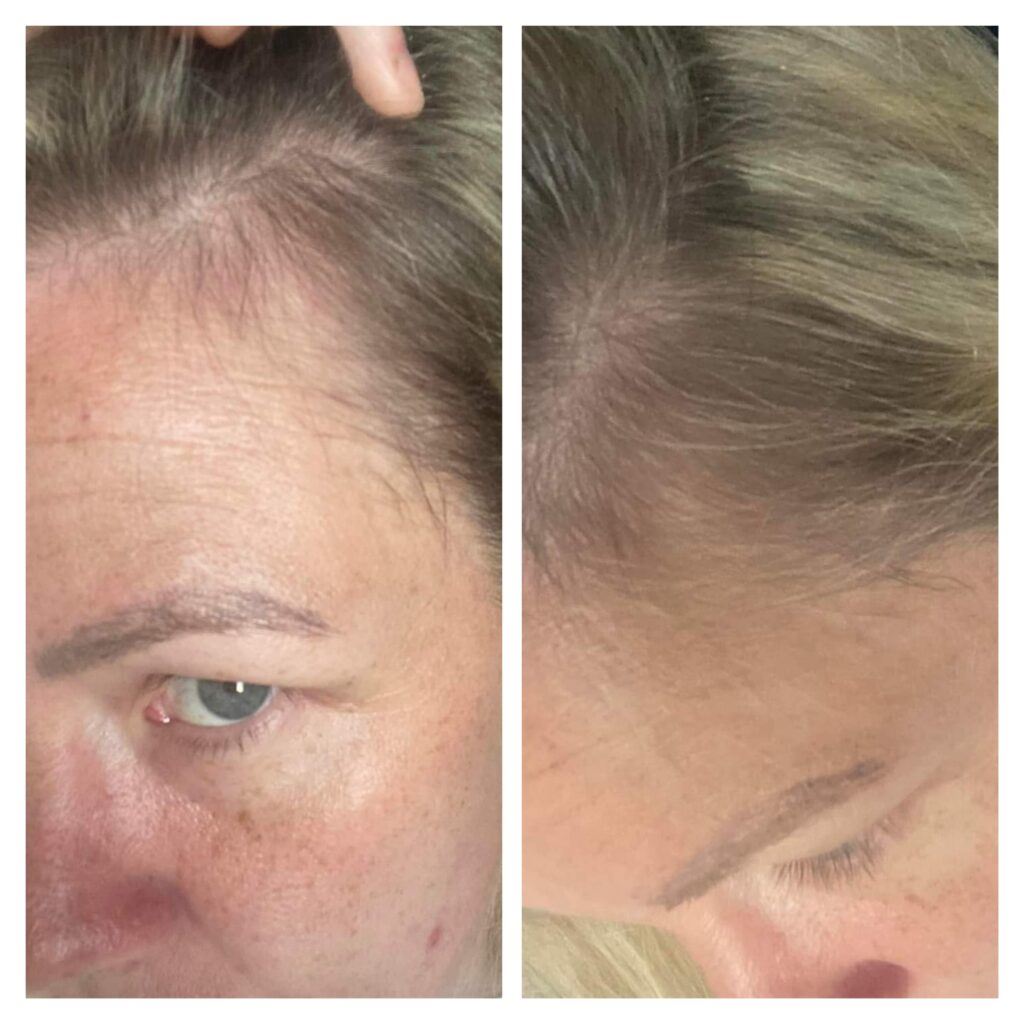 Before and after photo of hair growing back after using Glow liquid collagen