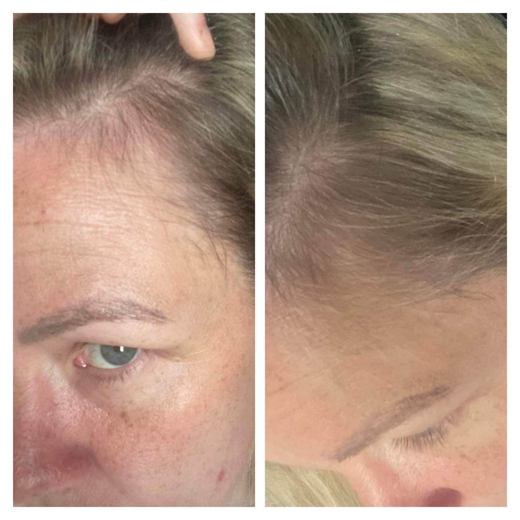 Before and after photo of hair growing back after using Glow liquid collagen