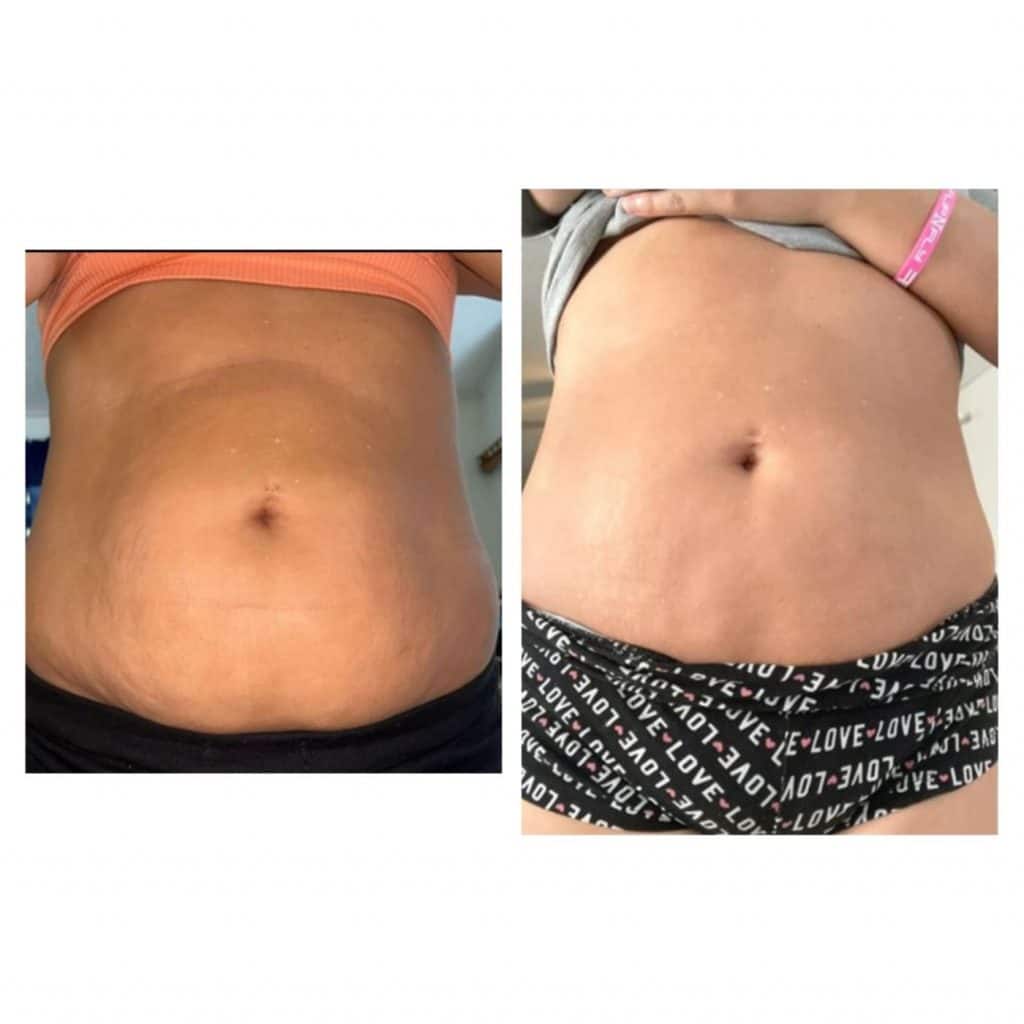 Before and after results from using Glow liquid collagen