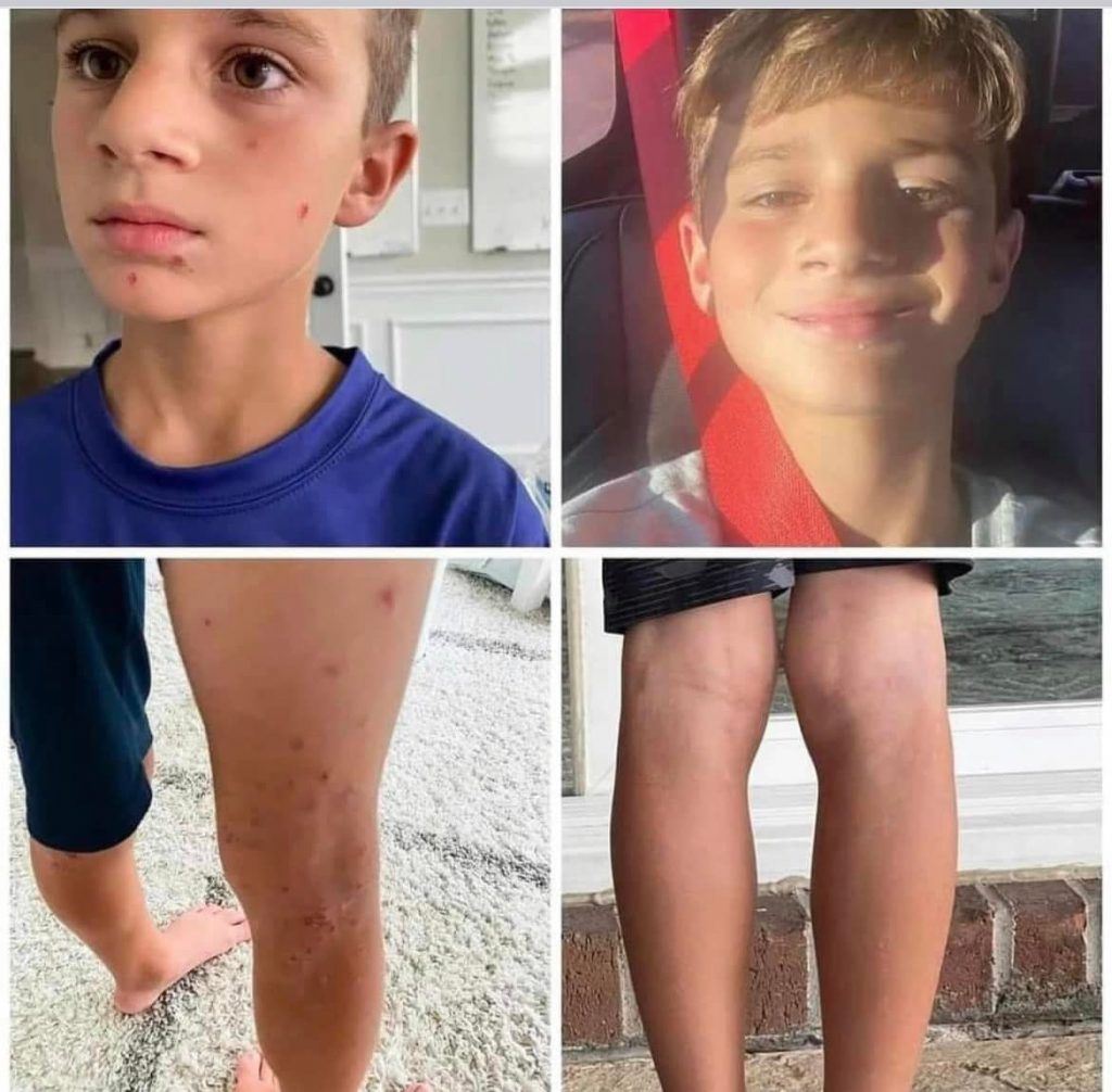 Before and after results from using Enrich digestive enzymes