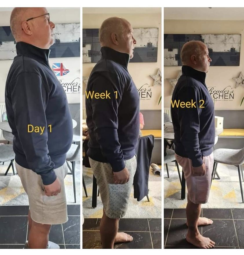 Before and after photos after using Enrich digestive enzymes