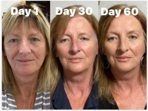 Before and after results from using Glow liquid collagen