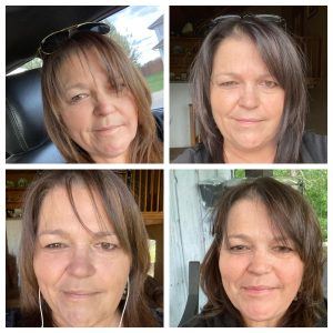 Before and after results from using Glow liquid collagen & Enrich digestive enzymes