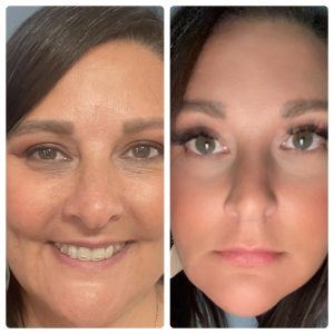 Before and after results from using Glow liquid collagen & Enirch digestive enzymes