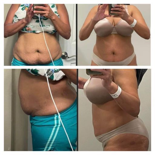 Before and after photos showing results of using Enrich digestive enzymes.