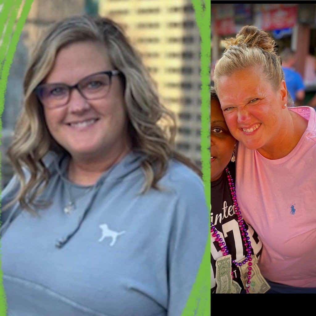 before and after photos of women using Tranont products