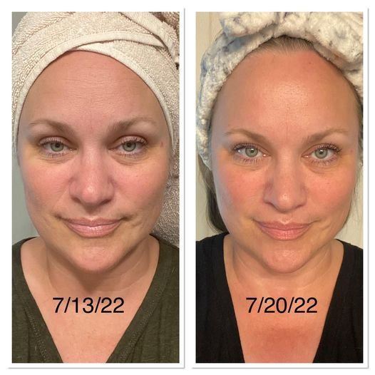 Before & after photo of personal results from using Glow Liquid Collagen, Zest & Mojo coffee replacement