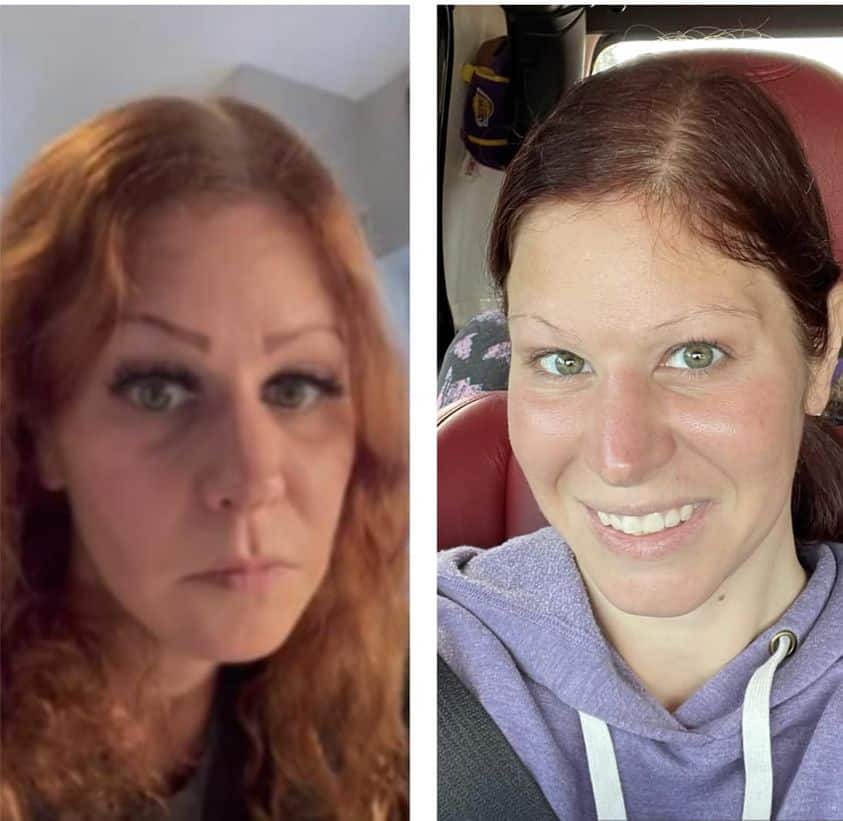Before & after photo of personal results from using Rejuvenate hydrating serum