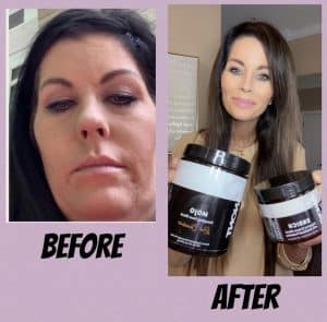 Before and after photo of personal results after using Mojo coffee replacement and Enrich digestive enzymes