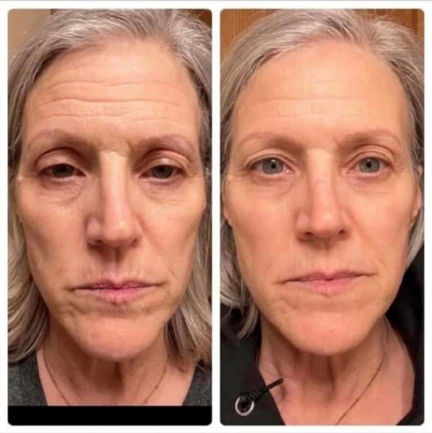 Before & after photo of personal results from using Glow Liquid Collagen