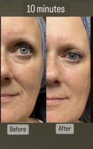 10 minute before and after results after using Rejuvenate hydrating serum