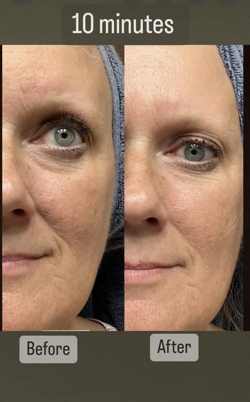 10 minute before and after results after using Rejuvenate hydrating serum