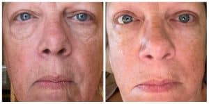 Before & After photo with personal results of using Glow Liquid Collagen