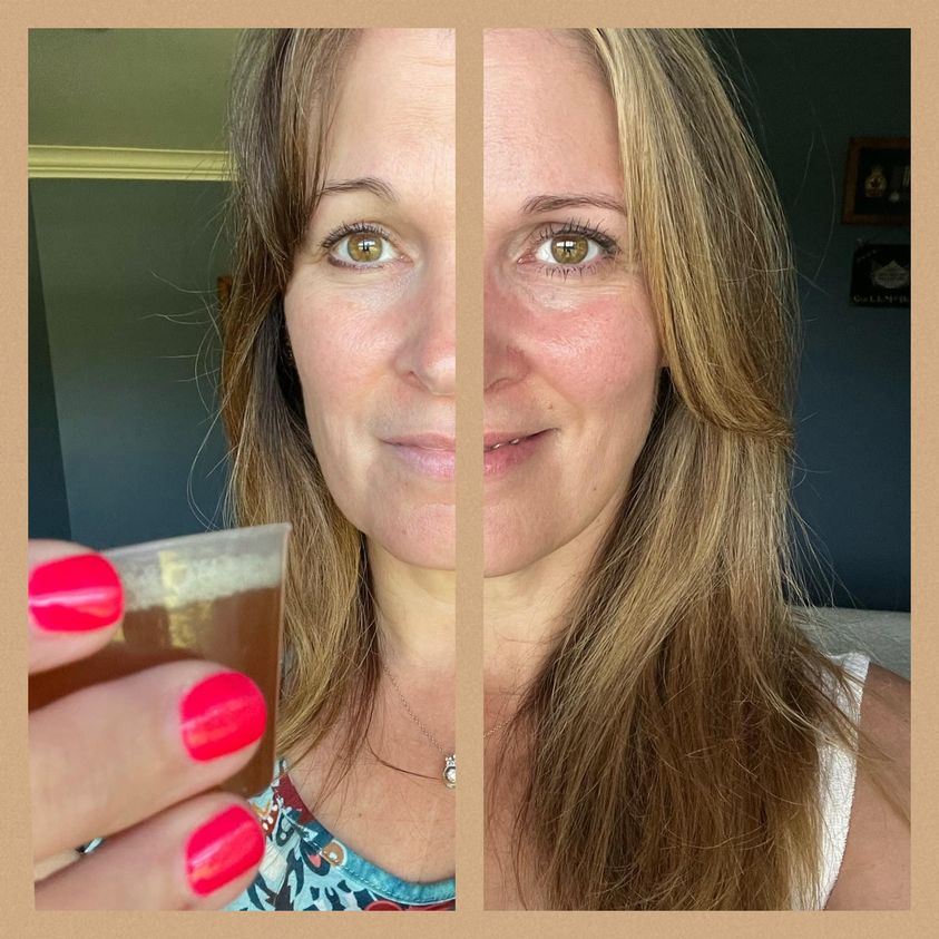 Before & After results of using Glow Liquid Collagen