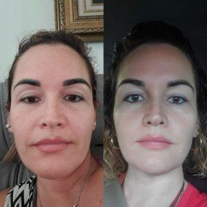 Before & After photo with personal results of using Glow Liquid Collagen