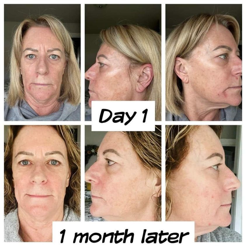 health progress of rejuvenate