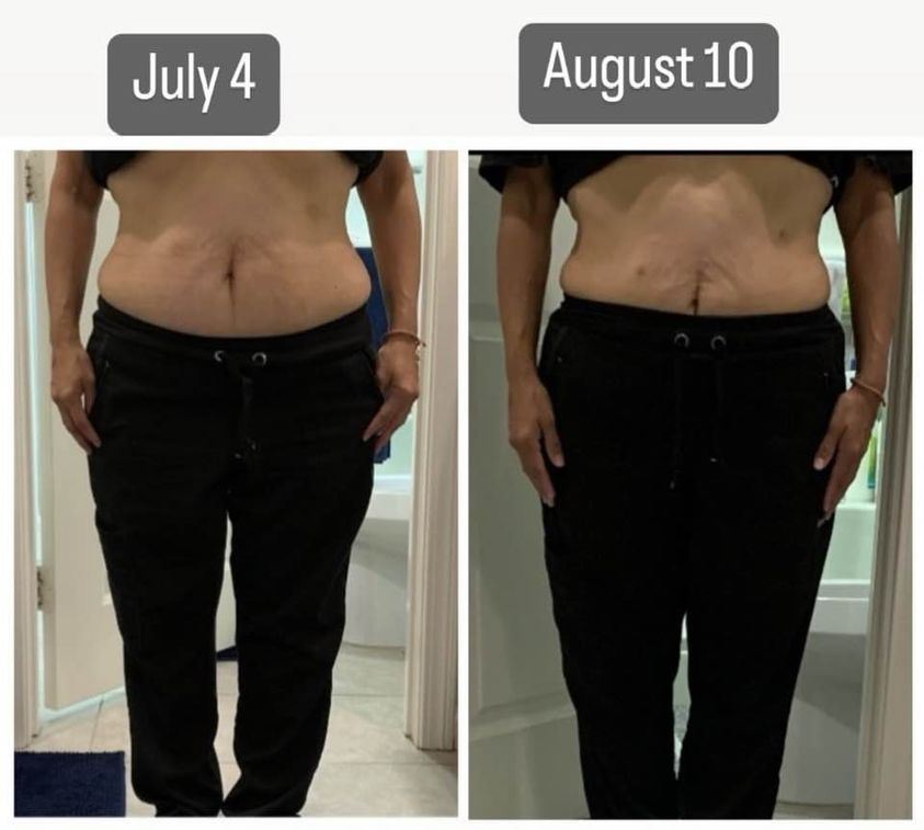 A lady in pants showing before and after results from Glow