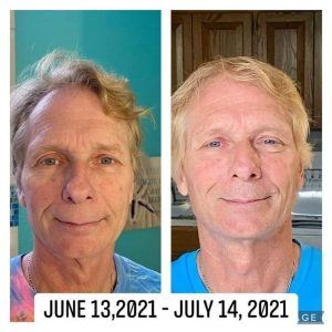A man's before and after photos from taking Glow liquid collagen