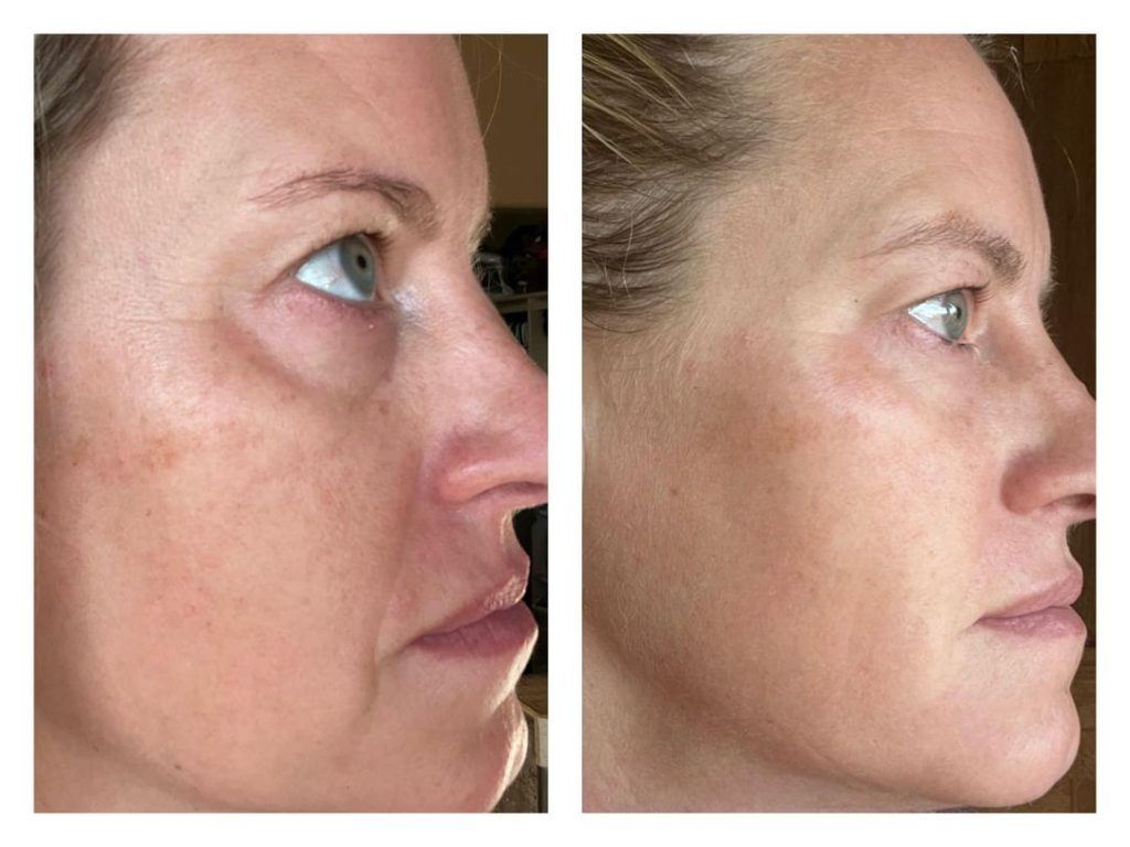 Results from using Glow and rejuvenate