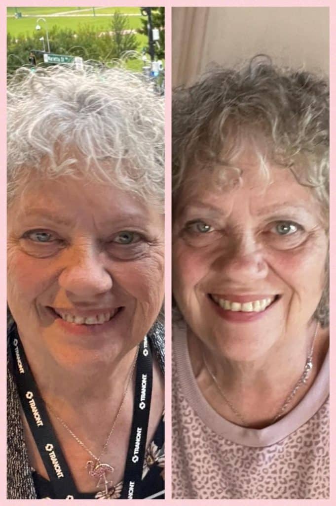 A women's before and after pics from taking Rejuvenate