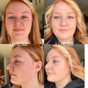 Before and after results from Rejuvenate hydrating serum