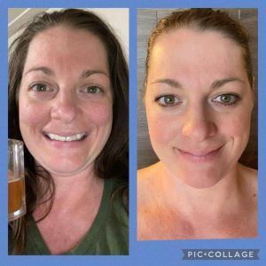 Before and after photo after using Glow liquid collagen