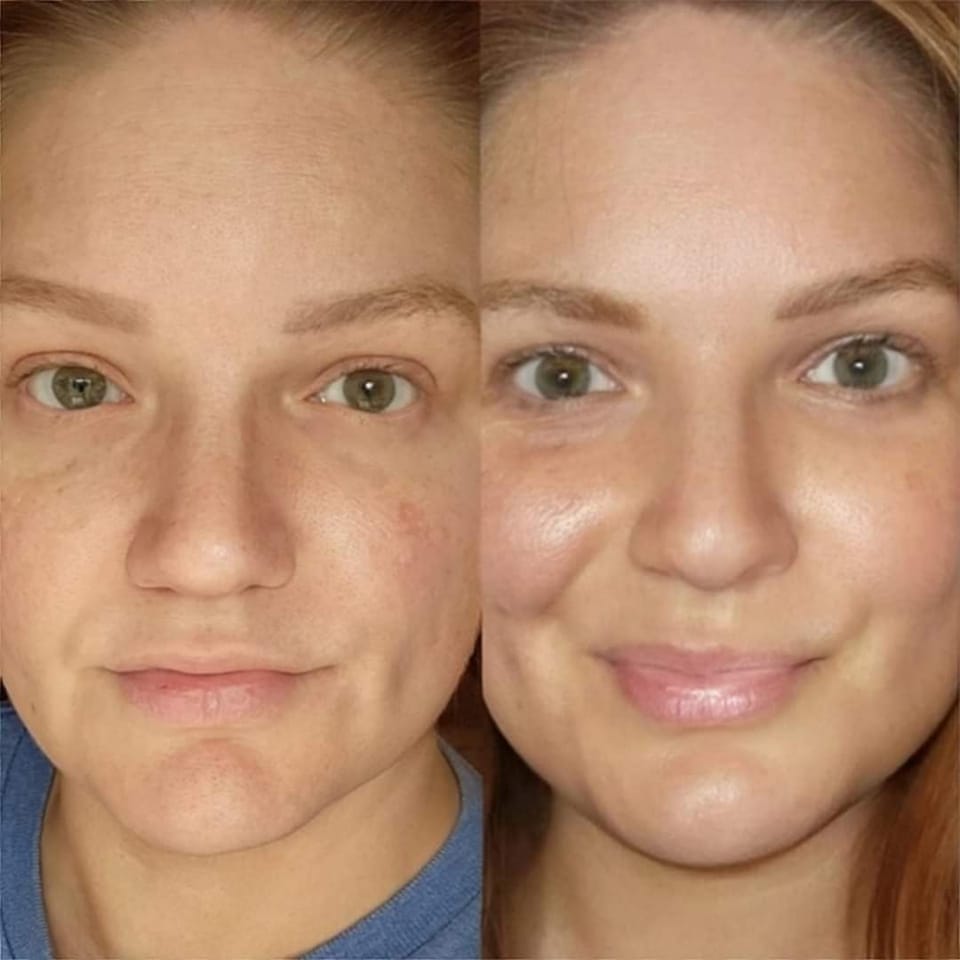 before and after of face from using Glow