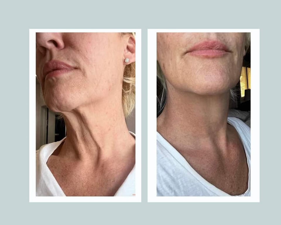 before and after from Glow Collagen