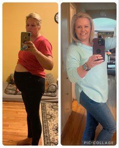 Before and after photo of woman