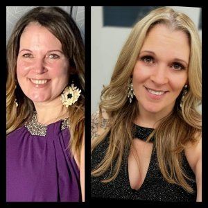 before and after photo of women from weight loss