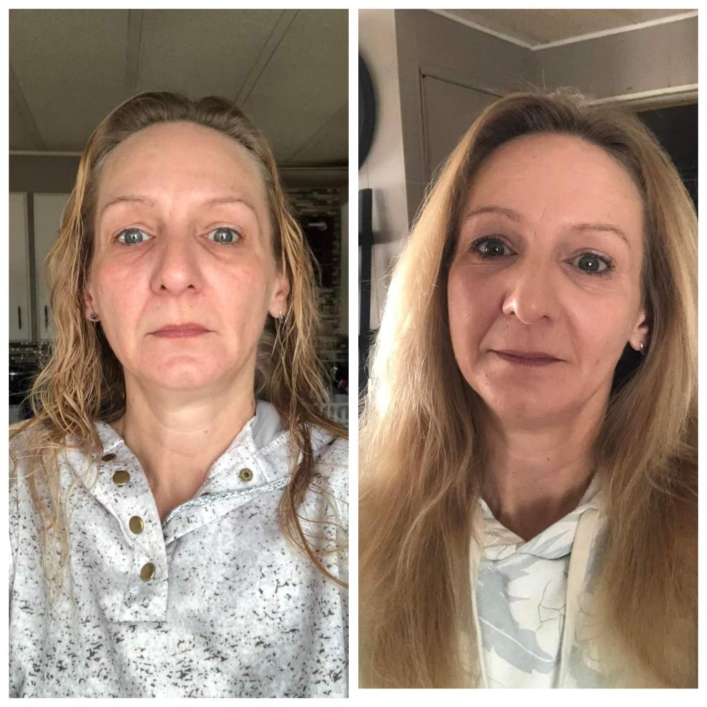 before and after photos from Glow collagen