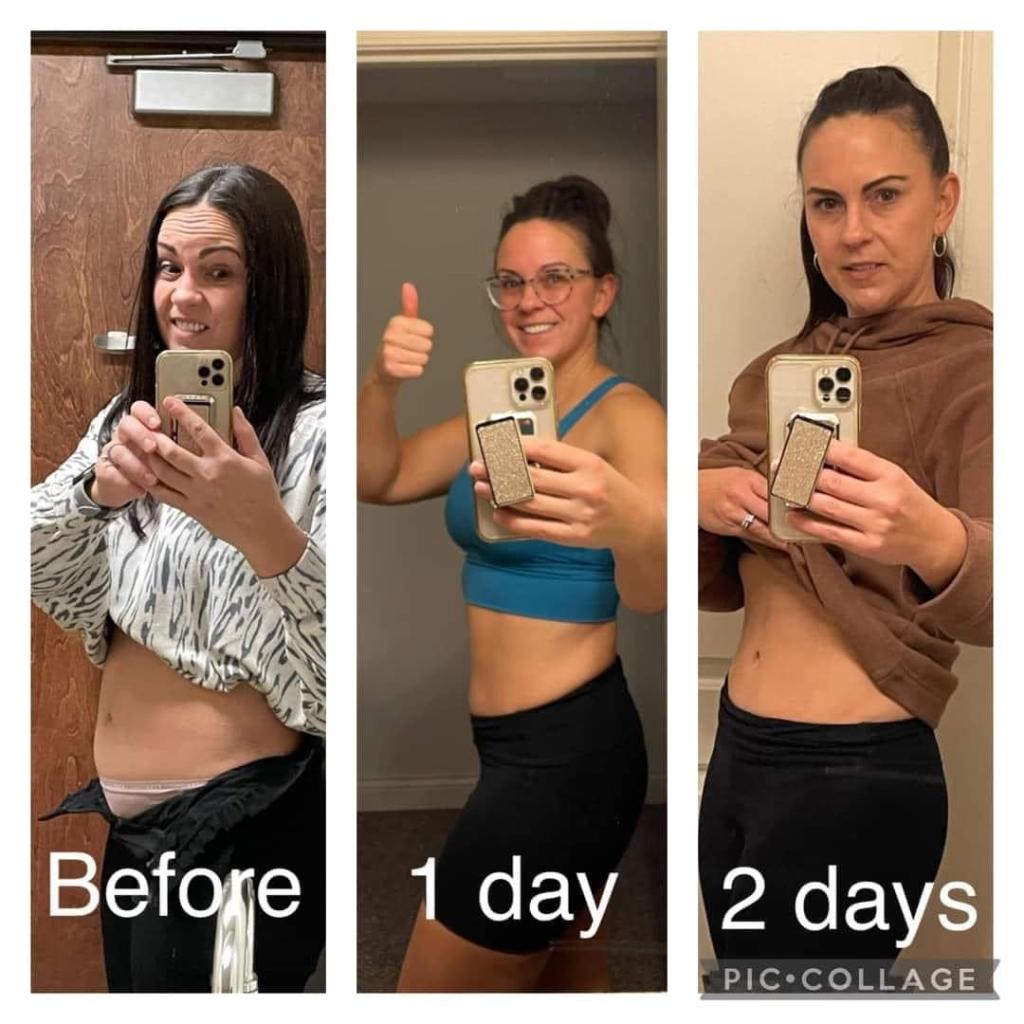 Before and after photo of bloated stomach