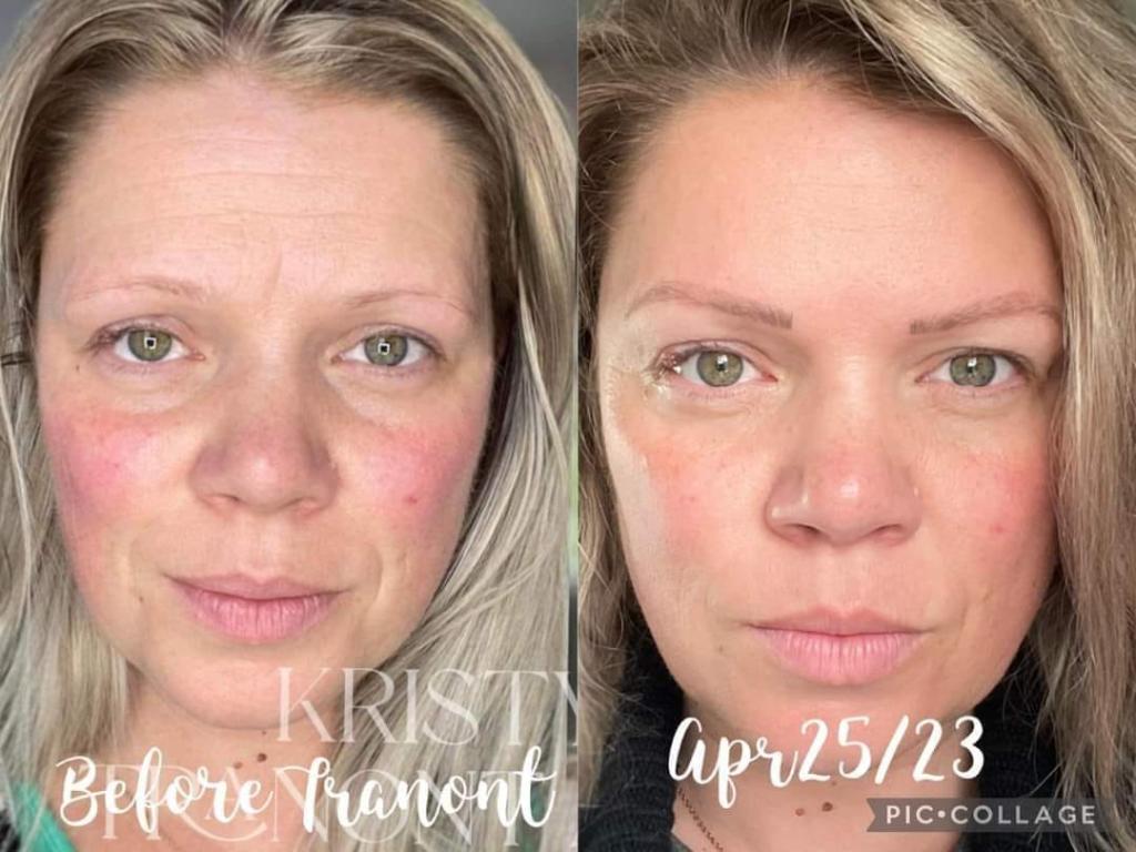 Before and after photo of face