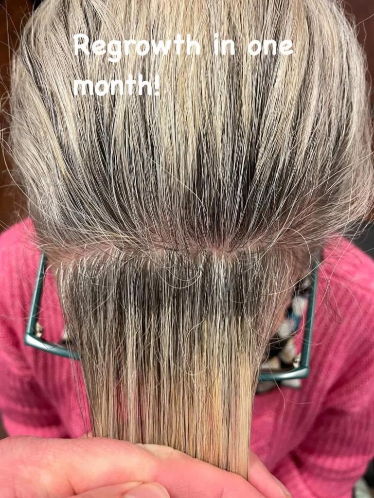 picture of extreme hair growth from Glow