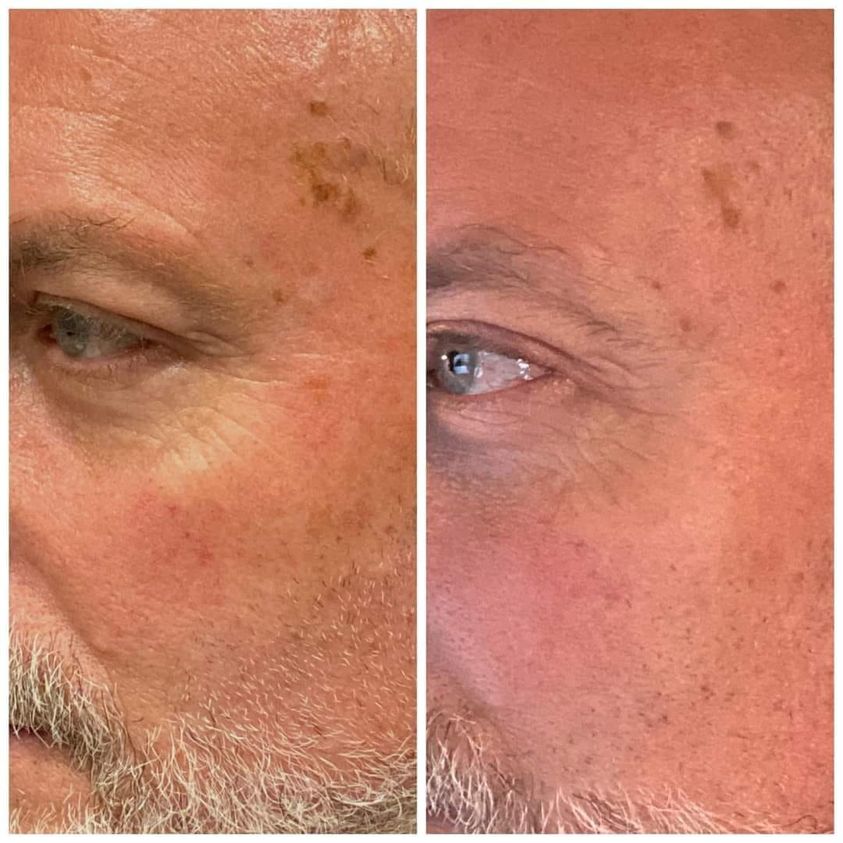 man's photo of before and after using Glow