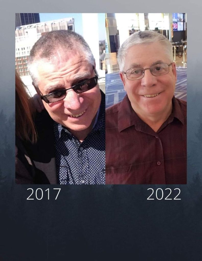 before and after photos of hairloss from using Glow